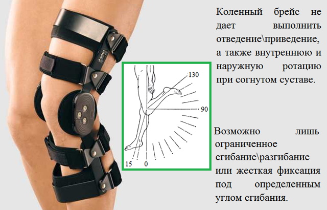 Брейсы для коленного сустава. Отзывы, цена