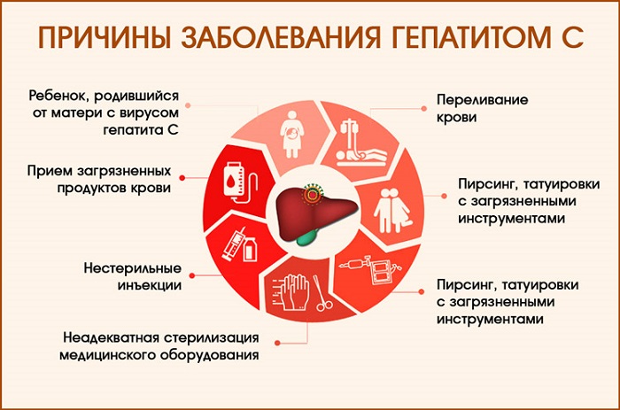 Гепатит С (Вирусный гепатит С): всё о заболевании, как передается, лечится