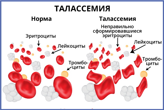 Малокровие у женщин. Симптомы, причины, лечение