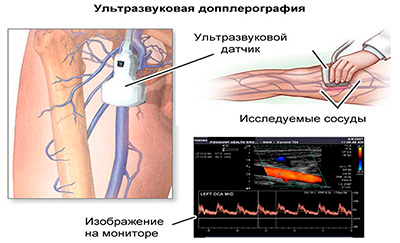 Немеет правая нога ниже колена. Причины, лечение