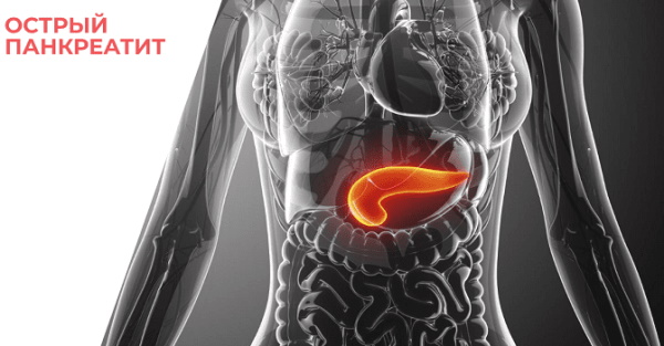 Острый панкреатит у женщины. Симптомы и лечение, препараты