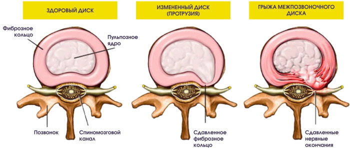Диски позвоночника нумерация фото