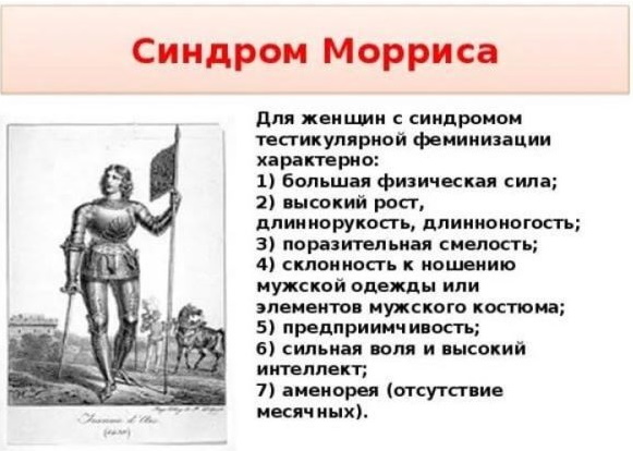 Синдром морриса фото людей известных