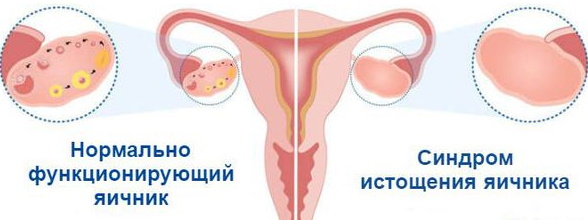 Трисомия по X-хромосоме синдром. Причины, диагностика, лечение