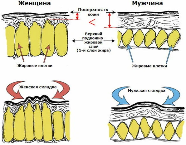 Целлюлит у мужчин фото