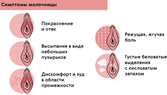 Выделения при молочнице. Фото, могут ли быть желтые, коричневые, розовые