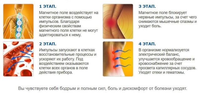 Алмаг-01 для лечения коленного сустава. Отзывы