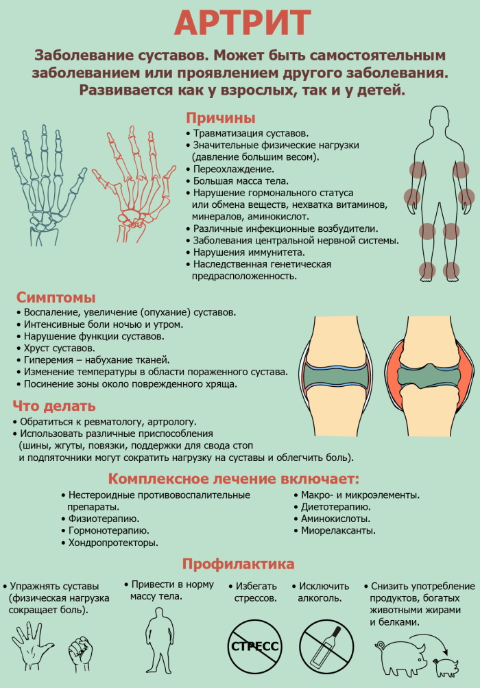 Тренажер Долинова Похудей для суставов. Отзывы