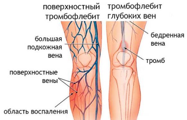 Биоптрон (Bioptron) лампа. Инструкция по применению, показания, цена, отзывы