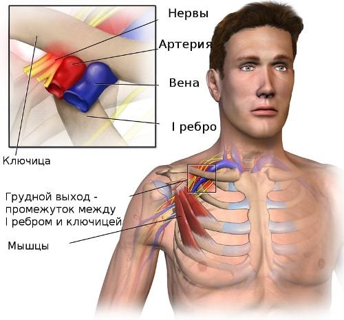 Боль в ключице слева, справа. Причины у женщин, мужчин