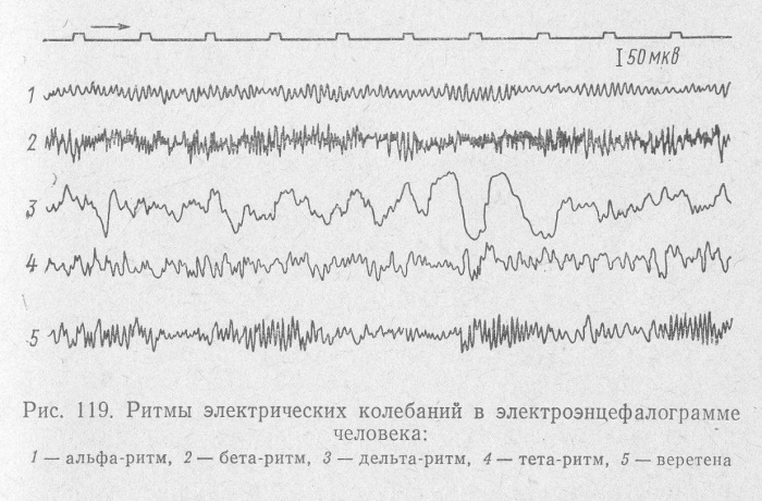 ЭЭГ (электроэнцефалография) у детей. Норма и нарушения, расшифровка