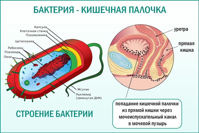 Гемолитическая кишечная палочка у взрослых. Симптомы, лечение