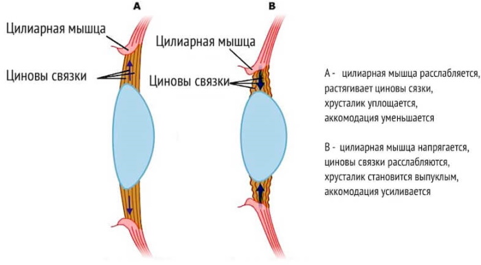 Спазм аккомодации глаз у детей. Что это такое, лечение