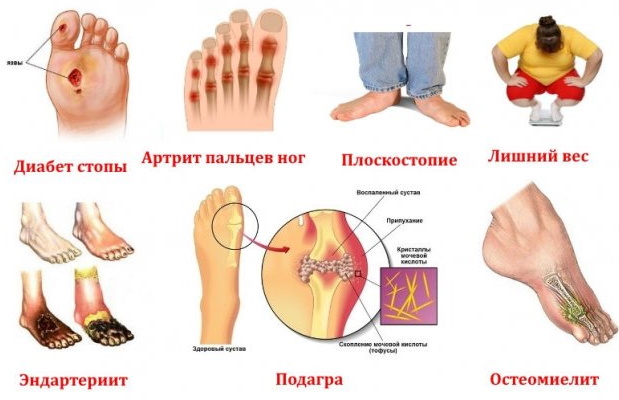 Онемел большой палец на правой ноге и не проходит