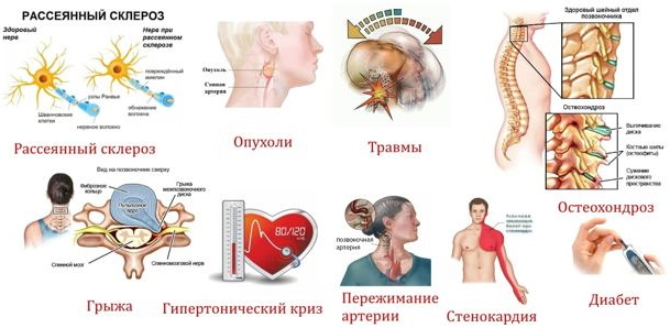 Онемение затылочной части головы. Причины