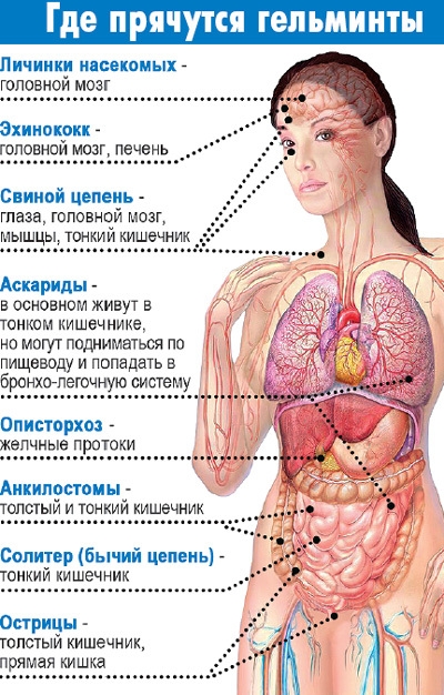 Паразитоз. Симптомы и лечение у взрослых, детей