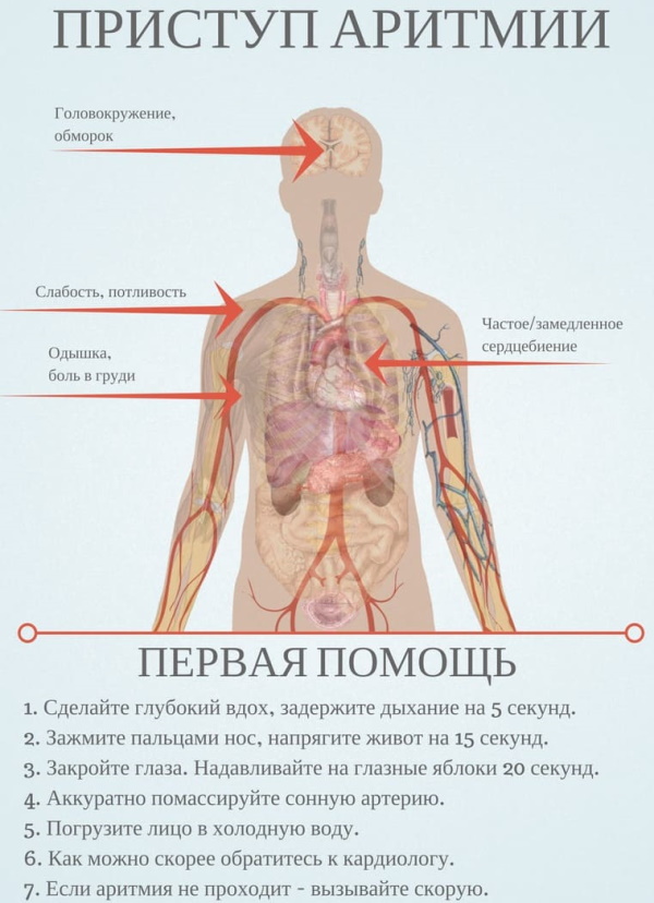 Перебои в сердце. Причины, что делать, отзывы врачей