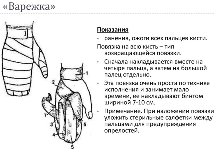 Повязка варежка на кисть. Алгоритм, техника наложения, показания