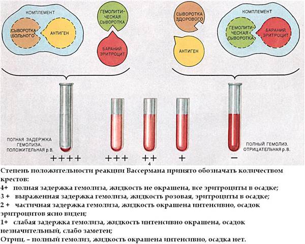 Реакция Вассермана (RW). Что это за анализ, как сдавать, сколько делается