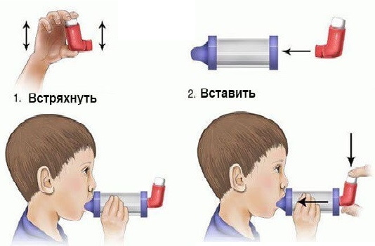 Спейсеры для ингаляций для детей. Как пользоваться