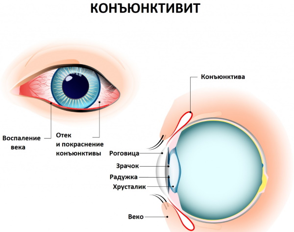 Теагель для глаз. Инструкция, цена, отзывы