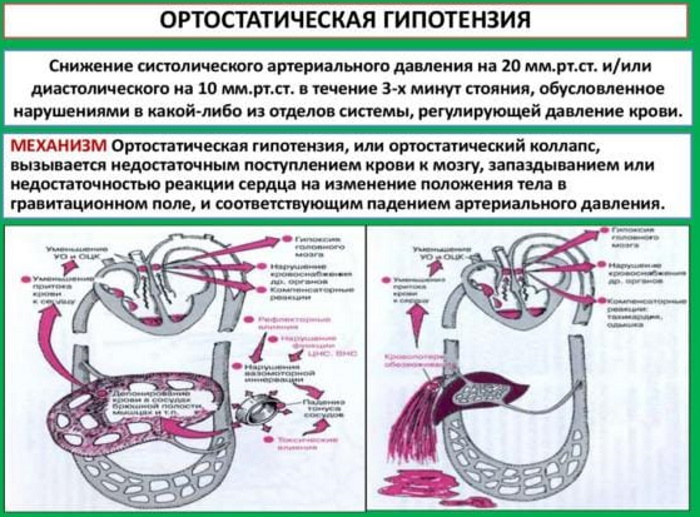 Темнеет в глазах и кружится голова. Причины у подростка, мужчин, женщин