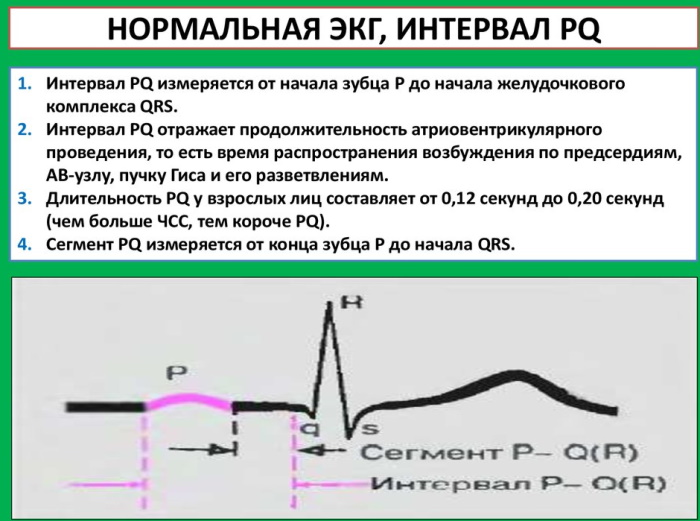 Как прочитать электрокардиограмму сердца самому. Расшифровка ЭКГ