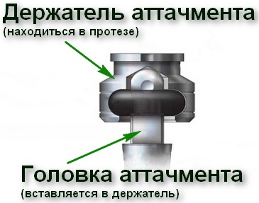 Условно-съемный протез на имплантах на верхнюю, нижнюю челюсть. Цена