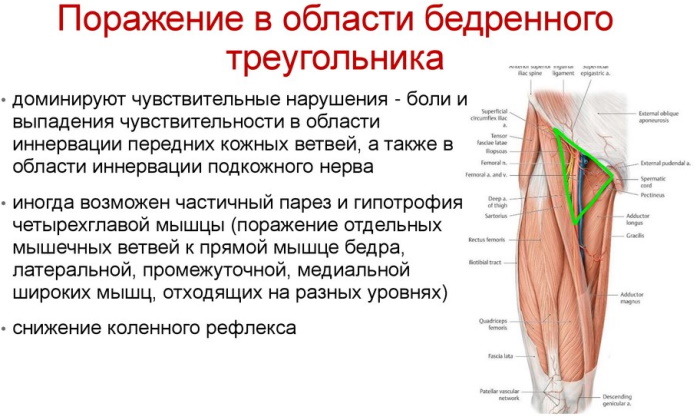 Фото седалищного нерва в ягодице