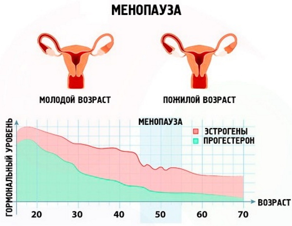 Миома матки. Чем опасна во время беременности, менопаузы