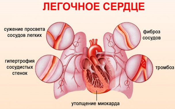 Конфигурация сердца в норме, при патологии