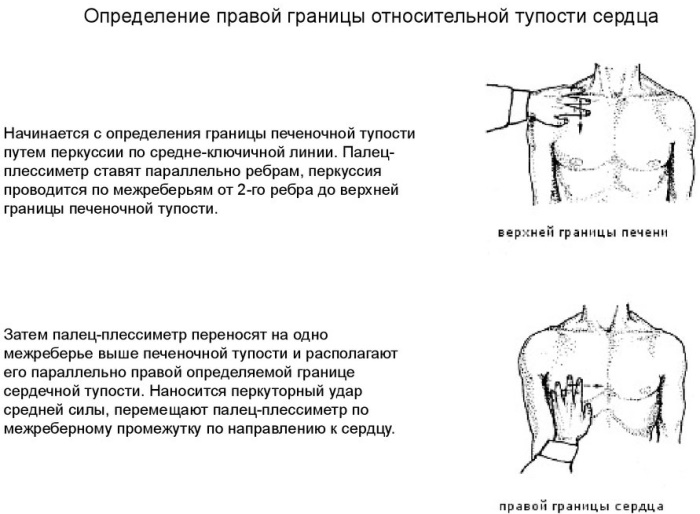 Конфигурация сердца в норме, при патологии