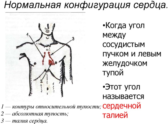 Конфигурация сердца в норме, при патологии