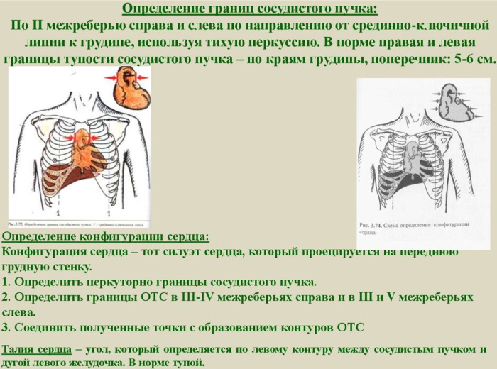 Конфигурация сердца в норме, при патологии