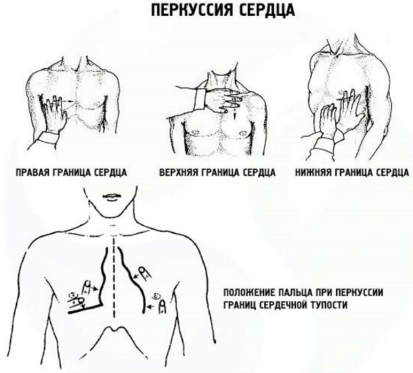 Конфигурация сердца в норме, при патологии