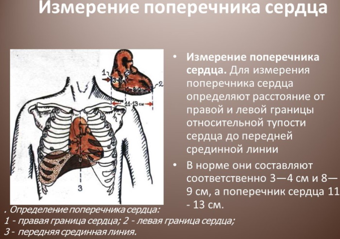 Конфигурация сердца в норме, при патологии