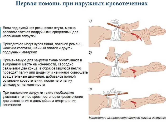 Кубитальная вена. Фото, что это, где находится