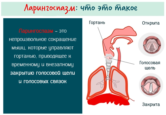 Ларингоспазм у детей фото