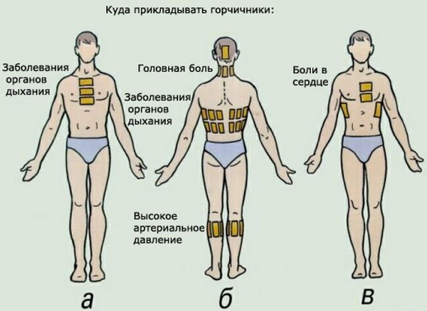 Обострение хронического бронхита. Лечение, симптомы