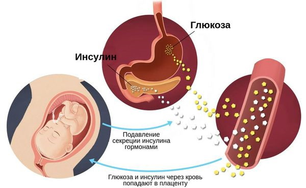 Повышенная глюкоза в крови при беременности