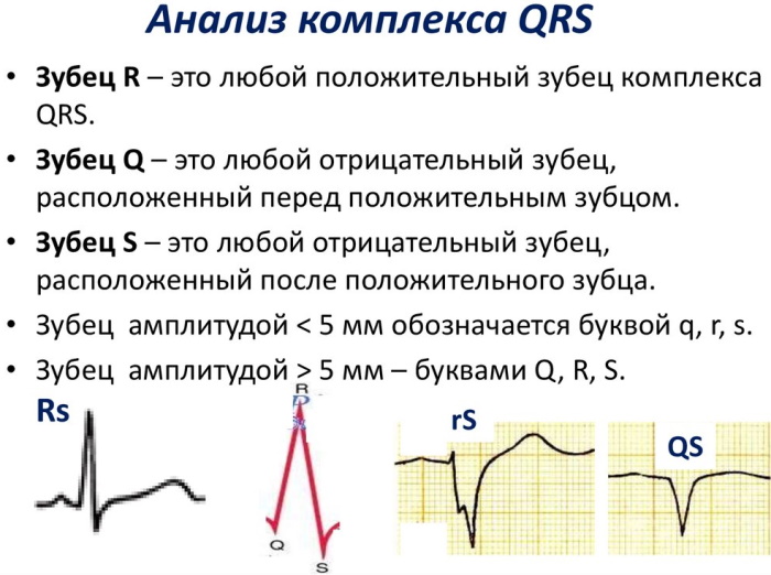 QRS комплекс ЭКГ: норма, тахикардия, что отражает узкие, широкие qrs