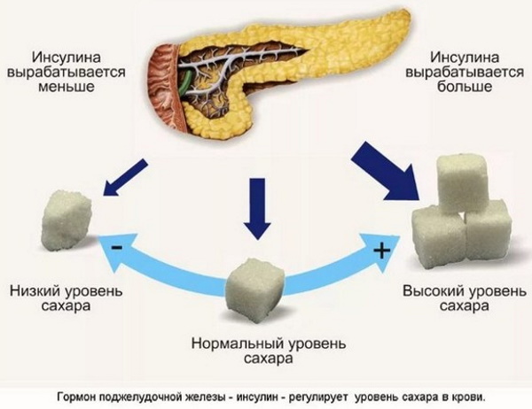 Повышенная глюкоза в крови при беременности