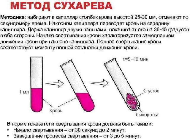 Анализ свертываемости крови методом корреляции цифровых спекл изображений