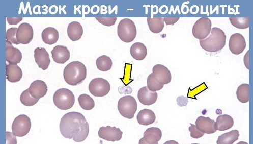 Тромбоциты. Норма у детей по возрасту, таблица