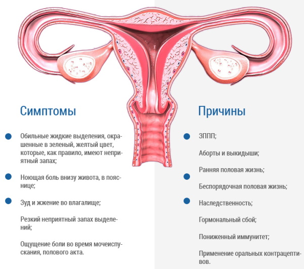 Цервикальная эктопия при хроническом цервиците