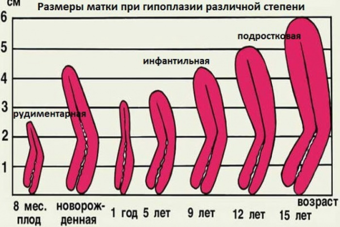 Матка женщины: виды, названия, анатомия, строение, размеры