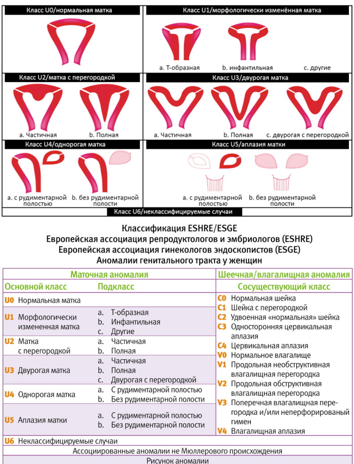 Матка женщины: виды, названия, анатомия, строение, размеры