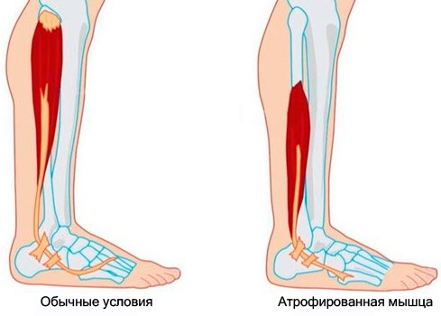 Мышцы на ногах фото