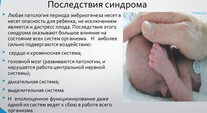 Дистресс плода при родах. Что это, последствия