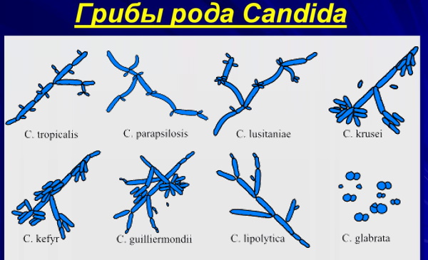 Дрожжевые грибы в мазке у женщин. Лечение, что это такое